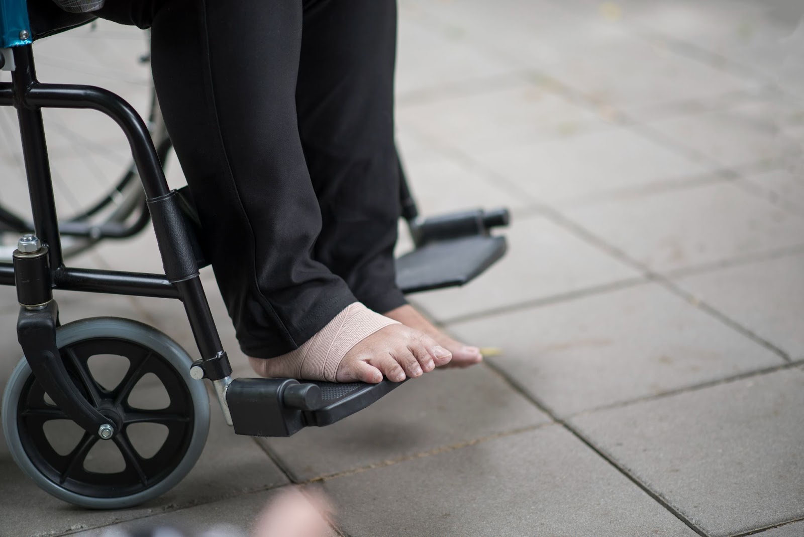 Close-up of feet resting on wheelchair footrest during general mobility physiotherapy session